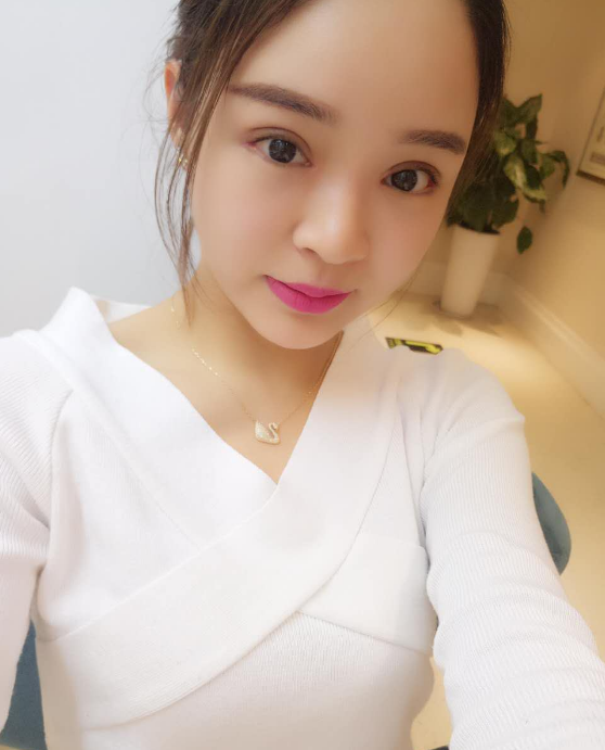美萊案例王曉航對比圖后