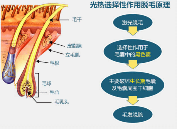 重慶華美腿毛太多如何持久脫毛