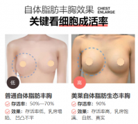 昭通做自體脂肪豐胸，怎么提高脂肪存活率