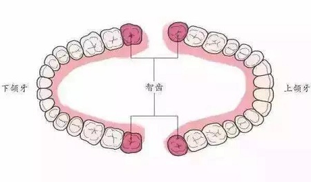 智齒