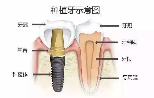 牙齒矯正