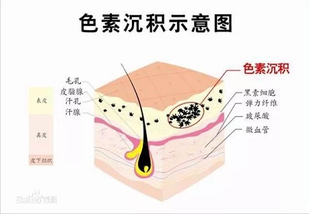 盤點四種需要來一針的膚質(zhì)