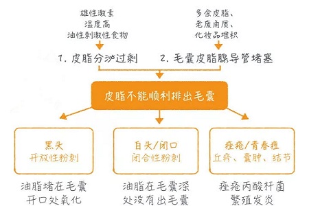 擠痘竟然被送進ICU！你的痘痘還好嗎？