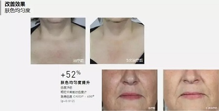 抗衰老的“水光”究竟為何飽受稱贊？