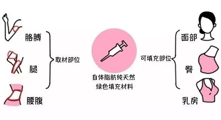 腿再瘦一點(diǎn)？腰再細(xì)一點(diǎn)？胸再大一點(diǎn)？自體脂肪填充，一步到位！