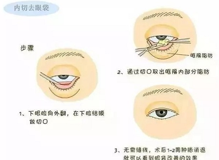 還把眼袋當(dāng)臥蠶？那就別怪小弟弟喊你阿姨了