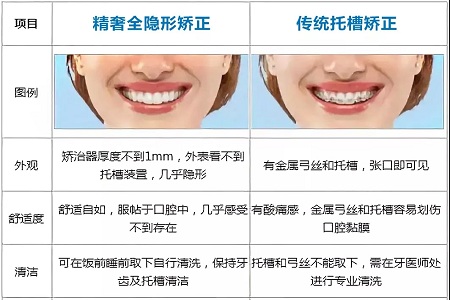 這種牙齒矯正方式，96%的人都會選擇！