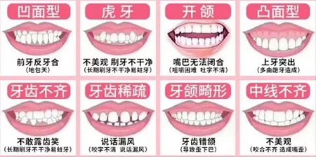 有效數(shù)據(jù)生成，預(yù)見(jiàn)牙齒矯正后的自己