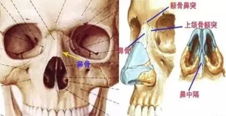 側(cè)面看鼻梁不矮,正面看鼻子卻很塌是什么原因？