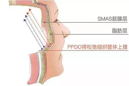 面部線雕有哪些好處