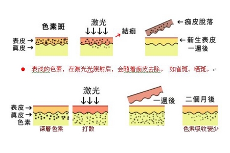 祛斑方法有哪幾種？這些祛斑小妙招你需要掌握