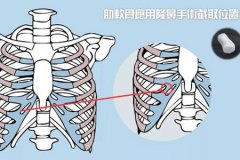 深圳隆鼻醫(yī)院做軟骨隆鼻多少錢，術(shù)后安全嗎